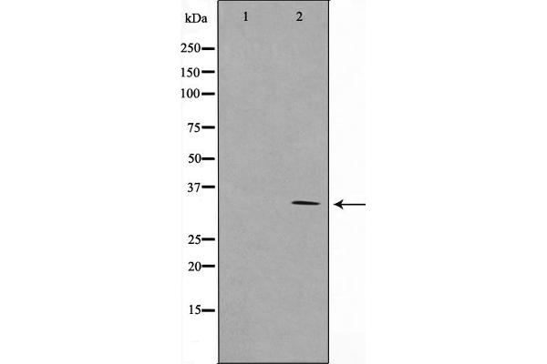 RNF144A antibody  (Internal Region)