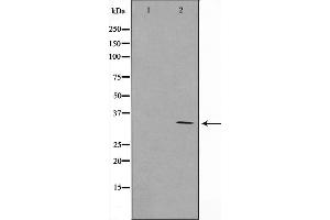 Western blot analysis on COLO205 cell lysate using RNF144A Antibody，The lane on the left is treated with the antigen-specific peptide. (RNF144A antibody  (Internal Region))