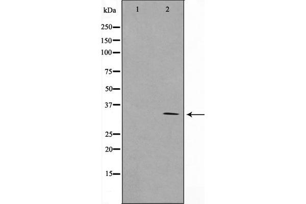 RNF144A antibody  (Internal Region)