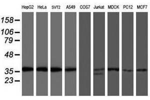 Image no. 1 for anti-O-Sialoglycoprotein Endopeptidase (OSGEP) (AA 1-335) antibody (ABIN1490751) (OSGEP antibody  (AA 1-335))