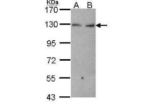 WB Image Sample (30 ug of whole cell lysate) A: Hela B: JurKat 7. (CDH6 antibody)