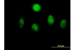 Immunofluorescence of  purified  MaxPab antibody to MYST2 on HeLa cell. (MYST2 antibody  (AA 1-611))
