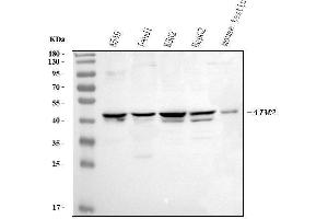 Western blot analysis of AIM2 using anti-AIM2 antibody (ABIN3043780).