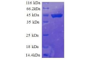 Ribosomal Protein S11 (RPS11) (AA 2-158), (full length) protein (GST tag)