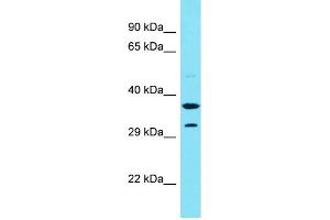 Host: Rabbit Target Name: CENPVP1 Sample Type: Fetal Liver lysates Antibody Dilution: 1. (CENPVP1 antibody  (C-Term))