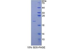SDS-PAGE (SDS) image for Protein O-Fucosyltransferase 1 (POFUT1) (AA 238-388) protein (His tag) (ABIN6238941) (POFUT1 Protein (AA 238-388) (His tag))