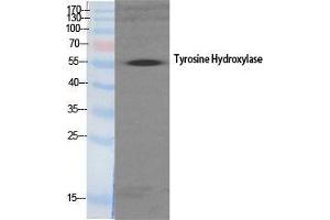Western Blot (WB) analysis of specific cells using TH Polyclonal Antibody. (TH antibody  (Tyr161))