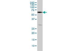 OXSR1 monoclonal antibody (M09), clone 5D5 Western Blot analysis of OXSR1 expression in HeLa . (OXSR1 antibody  (AA 351-450))