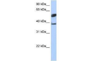 SPOPL antibody used at 5 ug/ml to detect target protein. (SPOPL antibody  (N-Term))