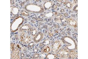 ABIN6266800 at 1/100 staining human kidney tissue sections by IHC-P. (MAP3K6 antibody  (C-Term))