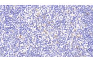 Immunohistochemistry (IHC) image for anti-Poly (ADP-Ribose) Polymerase Family, Member 4 (PARP4) (AA 338-609) antibody (ABIN7435292)
