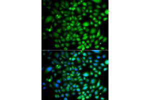 Immunofluorescence analysis of A549 cell using PTK6 antibody. (PTK6 antibody)