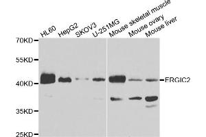 Western blot analysis of extracts of various cell lines, using ERGIC2 antibody. (ERGIC2 antibody)