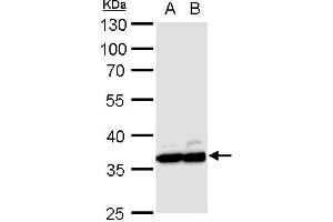 Western Blotting (WB) image for anti-Glyceraldehyde-3-Phosphate Dehydrogenase (GAPDH) antibody (ABIN2857072)