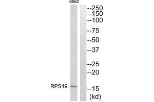 Western Blotting (WB) image for anti-Ribosomal Protein S19 (RPS19) (Internal Region) antibody (ABIN1850576)