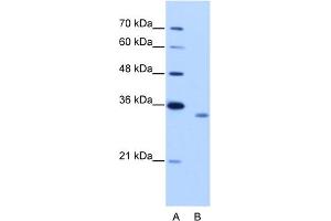WB Suggested Anti-RBM4B Antibody Titration:  2. (RBM4B antibody  (C-Term))