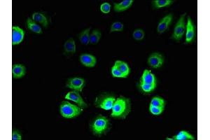 anti-Solute Carrier Family 36 (Proton/amino Acid Symporter), Member 3 (SLC36A3) (AA 1-46) antibody
