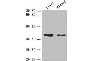 Western blot All lanes: FCGRT antibody at 5. (FcRn antibody  (AA 24-297))
