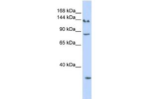 WB Suggested Anti-SIN3A Antibody Titration:  0. (SIN3A antibody  (N-Term))