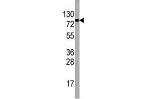 Western blot analysis of EIF4B antibody antibody and HepG2 lysate. (EIF4B antibody  (AA 353-382))