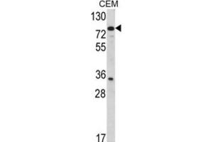 Western Blotting (WB) image for anti-Transglutaminase 4 (Prostate) (TGM4) antibody (ABIN5022825)