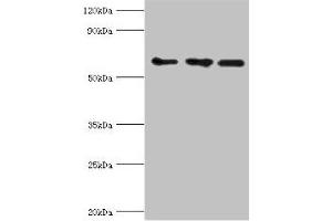 Western blot All lanes: ABCE1 antibody at 4 μg/mL Lane 1: 293T whole cell lysate Lane 2: Hela whole cell lysate Lane 3: k562 whole cell lysate Secondary Goat polyclonal to rabbit IgG at 1/10000 dilution Predicted band size: 67 kDa Observed band size: 67 kDa (ABCE1 antibody  (AA 320-599))