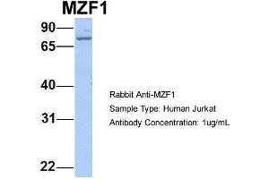 Host: Rabbit Target Name: MZF1 Sample Type: Jurkat Antibody Dilution: 1. (MZF1 antibody  (N-Term))