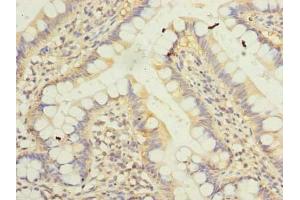 Immunohistochemistry of paraffin-embedded human small intestine tissue using ABIN7157240 at dilution of 1:100 (KLHDC8A antibody  (AA 1-350))