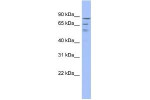 WB Suggested Anti-C1orf25 Antibody Titration:  0.