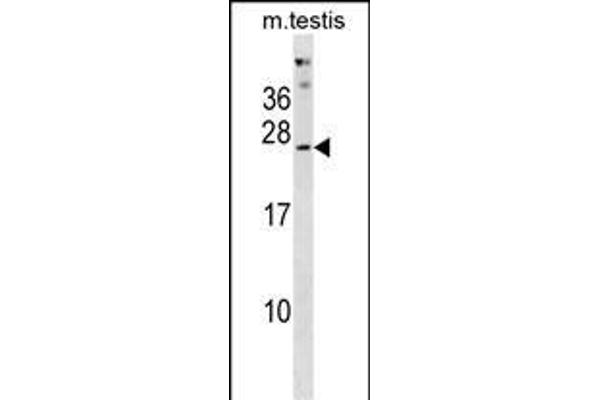 PHOSPHO2 antibody  (N-Term)