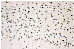 IHC analysis of VCP using anti-VCP antibody (ABIN3043958). (VCP antibody  (C-Term))