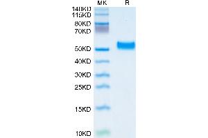 PEDF Protein (AA 20-418) (His tag)