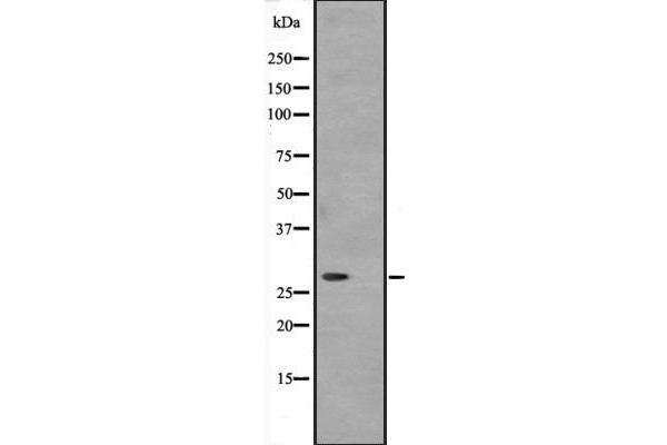 ATP6V1D antibody  (Internal Region)