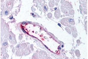 Human Vascular Endothelium (formalin-fixed, paraffin-embedded) stained with HUNK antibody ABIN213526 at 20 ug/ml followed by biotinylated goat anti-rabbit IgG secondary antibody ABIN481713, alkaline phosphatase-streptavidin and chromogen. (HUNK antibody  (C-Term))
