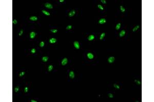 Immunofluorescence staining of Hela Cells with ABIN7127546 at 1:50, counter-stained with DAPI. (Recombinant SYNCRIP antibody)
