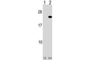Western blot analysis of ARF5 antibody and 293 cell lysate either nontransfected (Lane 1) or transiently transfected (2) with the ARF5 gene. (ARF5 antibody  (AA 80-108))