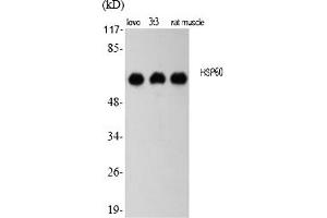 Western Blot analysis of various cells using HSP60 Polyclonal Antibody diluted at 1:2000. (HSPD1 antibody  (AA 480-560))