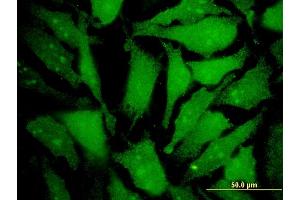 Immunofluorescence of monoclonal antibody to MGAT4B on HeLa cell. (MGAT4B antibody  (AA 401-500))