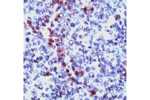 Image no. 1 for anti-Granzyme B (GZMB) (N-Term) antibody (ABIN372968) (GZMB antibody  (N-Term))
