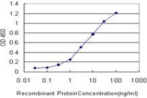 Detection limit for recombinant GST tagged TOM1 is approximately 0. (TOM1 antibody  (AA 394-491))