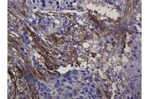 Immunohistochemistry (IHC) image for anti-Sterol O-Acyltransferase 2 (SOAT2) (AA 1-120) antibody (ABIN1490565) (SOAT2 antibody  (AA 1-120))