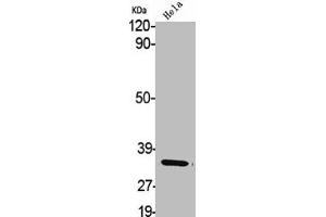 Western Blot analysis of HELA cells using Aldose Reductase Polyclonal Antibody (AKR1B1 antibody  (C-Term))