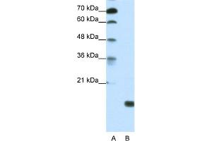 WB Suggested Anti-TGIF2LY Antibody   Titration: 1. (TGIF2LY antibody  (Middle Region))