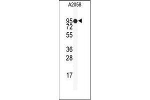 Image no. 1 for anti-Heat Shock Protein 90kDa alpha (Cytosolic), Class B Member 1 (HSP90AB1) (Middle Region) antibody (ABIN360230) (HSP90AB1 antibody  (Middle Region))