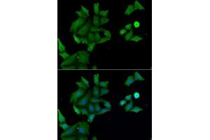 Immunofluorescence analysis of MCF7 cells using H antibody (ABIN6129030, ABIN6141583, ABIN6141584 and ABIN6222656). (HABP2 antibody  (AA 24-313))