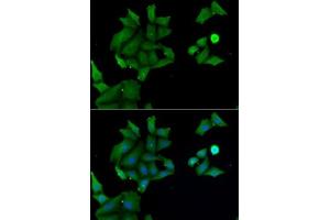 Immunofluorescence analysis of MCF7 cells using H antibody (ABIN6129030, ABIN6141583, ABIN6141584 and ABIN6222656). (HABP2 antibody  (AA 24-313))