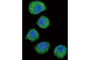 Confocal immunofluorescent analysis of FGFR2 Antibody (ABIN391968 and ABIN2841764) with  cell followed by Alexa Fluor 488-conjugated goat anti-rabbit lgG (green). (FGFR2 antibody)