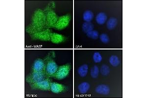 ABIN185368 Immunofluorescence analysis of paraformaldehyde fixed HepG2 cells, permeabilized with 0. (WASP antibody  (Internal Region))