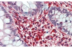 Detection of PLA2G2D in Human Small Intestine Tissue using Polyclonal Antibody to Phospholipase A2, Group IID (PLA2G2D) (PLA2G2D antibody  (AA 20-134))