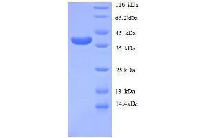 SDS-PAGE (SDS) image for Collagen, Type IV, alpha 1 (COL4A1) (AA 30-167), (partial) protein (GST tag) (ABIN1046837)